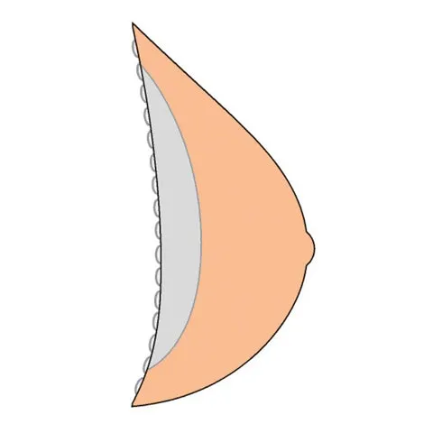 Amoena Contact Light 2S Breast Form