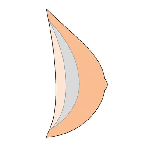 Amoena Natura Light 1S Breast Form